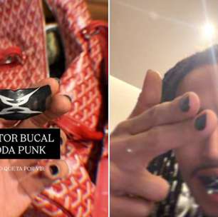 Matuê chama atenção ao exibir 'protetor bucal de roda punk' nas redes