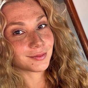 Atriz de 32 anos detalha recuperação após sofrer AVC: 'Maior susto'