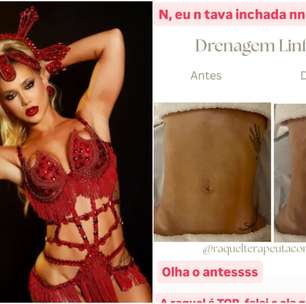 Virginia impressiona com antes e depois após drenagem linfática; conheça os benefícios