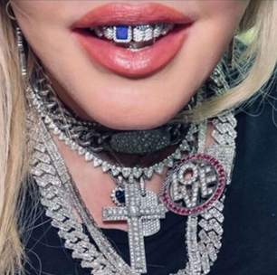 Preço de um carro? Madonna choca web com valor de joia no dente