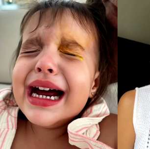 Menina de 2 anos tem corte na córnea durante brincadeira e mãe relata susto: 'Pode ficar cega?'