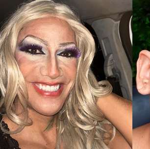 Homem denuncia homofobia ao ser agredido durante carnaval em Olinda (PE): 'Ele tentou me matar'