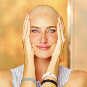 Atriz de Carinha de Anjo vive novo capítulo após fim da quimioterapia