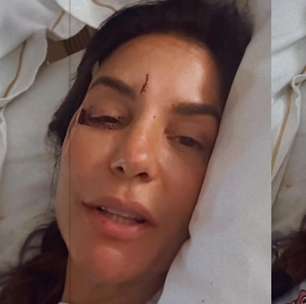 Internada, Ivete Sangalo aparece com rosto ferido e revela real estado de saúde