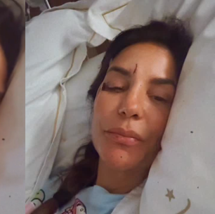 Ivete Sangalo é internada e mostra rosto machucado