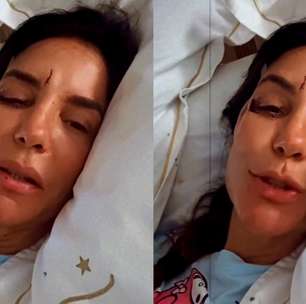 Com ferimentos no rosto, Ivete Sangalo grava vídeo do hospital: 'Desmaiei e caí no chão'