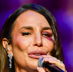 O pedido de Ivete Sangalo aos médicos antes de realizar cirurgia de emergência dias após acidente doméstico