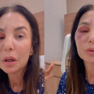 Síndrome do vasovagal: entenda a condição que provoca desmaios e foi diagnosticada em Ivete Sangalo