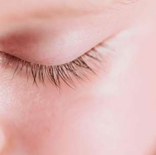 Caspa nos cílios? Descamação pode ser sinal de inflamação nos olhos