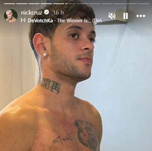 Ex-Estrela da Casa, Nick Cruz celebra mastectomia e diz viver recomeço