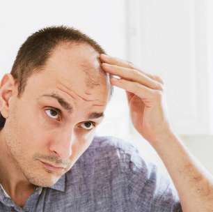 Por que homens ficam carecas e mulheres não?