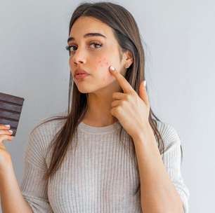 Chocolate x espinhas: mitos e verdades explicados de forma simples