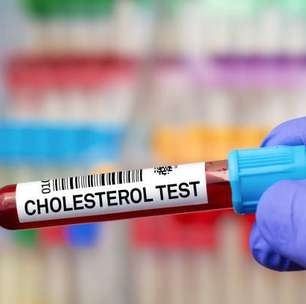 Maioria dos pacientes desconhece os riscos genéticos do colesterol
