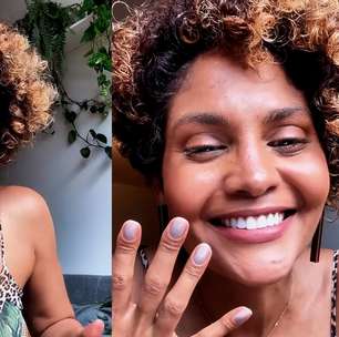 Bárbara Reis relata sinais ignorados por anos até descobrir lipedema: 'Achei que o problema era eu'