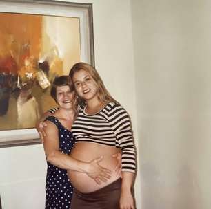 Poliana Rocha viraliza com foto de antes das plásticas