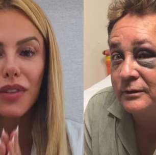 É grave? Poliana Rocha revela real estado de saúde de Leonardo após acidente em pescaria