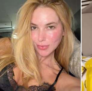 Virginia aparece com o rosto 'em carne viva' e especialista alerta: 'Devemos ficar atentos'