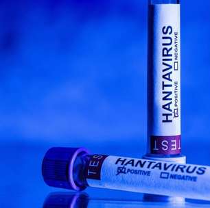 Mais de 20 franceses expostos ao hantavírus estão 'atualmente hospitalizados'