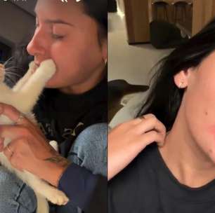O que fazer após alergia a pets? Caso de Ana Castela levanta alerta