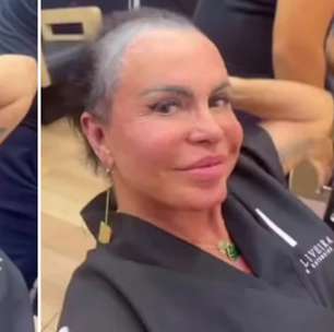 O que Gretchen fez no cabelo? Especialista alerta sobre os riscos do procedimento