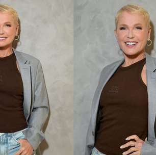 Xuxa revela que fez transplante capilar; entenda o procedimento