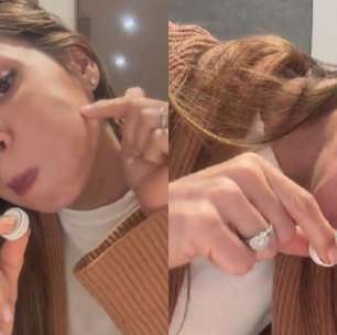 Maíra Cardi mostra complicações de preenchimento no rosto e alerta: 'É proibido'