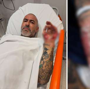 Henrique Fogaça diz que teve aliança roubada em hospital após acidente de moto