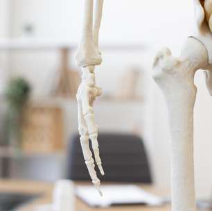Estudo pioneiro confirma os benefícios da artroplastia total do quadril