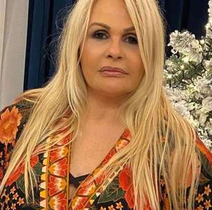 Monique Evans revela desejo de fazer minilifting; especialistas explicam quando a técnica é indicada