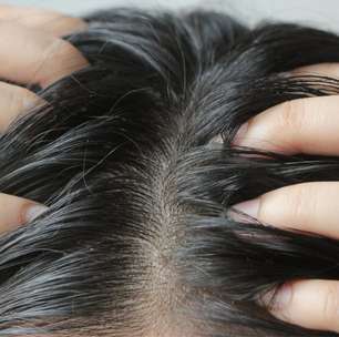 Cabelo com mau cheiro nem sempre é falta de lavagem; veja como evitar