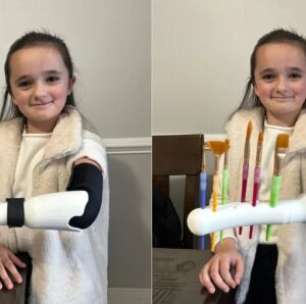 Universitário cria prótese em impressora 3D para ajudar irmã de 7 anos nas tarefas do dia a dia