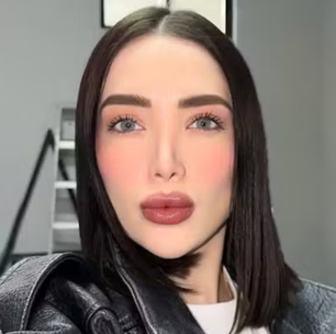 Adriana Garcia morre aos 30 anos após complicações em cirurgia plástica