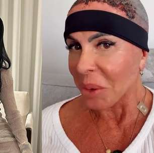 Gretchen atualiza recuperação após transplante capilar: 'Olha como estou bem'