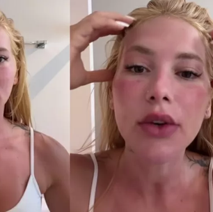 Grave? Virginia Fonseca aparece com rosto inchado e assusta seguidores
