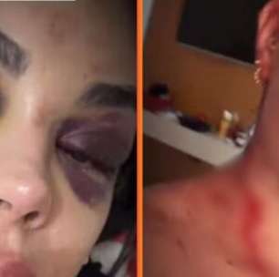 Ex-primeira-dama denuncia prefeito de Granito (PE) por violência doméstica