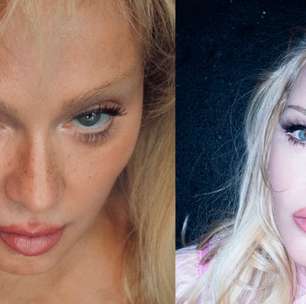 O segredo por trás do novo rosto de Madonna aos 68 anos que deixou fãs chocados