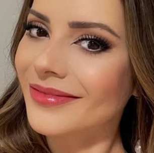 Plástica? Sandy atualiza feed e aparência surpreende internautas: 'Que rosto é esse?'