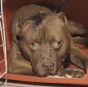Dois ataques de pitbull na mesma semana no Rio: menina de 3 anos morre e outra criança fica em estado grave