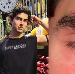 Ator de conteúdo adulto gay revela agressão após sair de bar LGBT+: "Estavam zombando do meu trabalho"