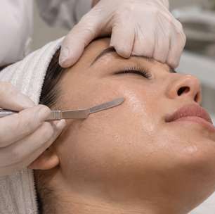 A tendência promete remover pelos e deixar a pele mais lisa, mas o dermaplaning caseiro pode cobrar um preço alto