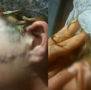 Homem que esfaqueou a ex no rosto e na orelha é preso por tentativa de feminicídio em GO