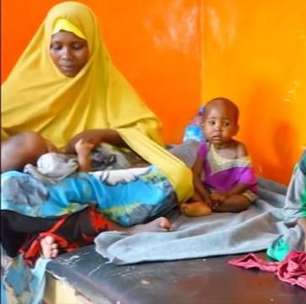 Unicef: 1,4 milhão de crianças podem morrer por desnutrição