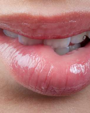 4 consejos para evitar que el herpes labial se forme