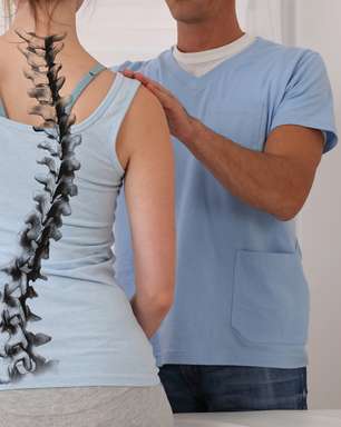 Entenda o que é a Escoliose Idiopática Adolescente (EIA)