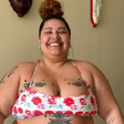 Ex-The Voice mostra cicatrizes de abdominoplastia após perder 90 kg; veja o resultado