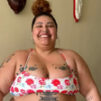 Ex-The Voice mostra cicatrizes de abdominoplastia após perder 90 kg; veja
