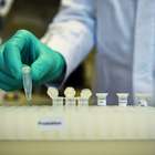 Hong Kong tem o primeiro caso de reinfecção do coronavírus