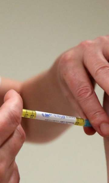 O que &eacute; o efeito placebo e como ele funciona?