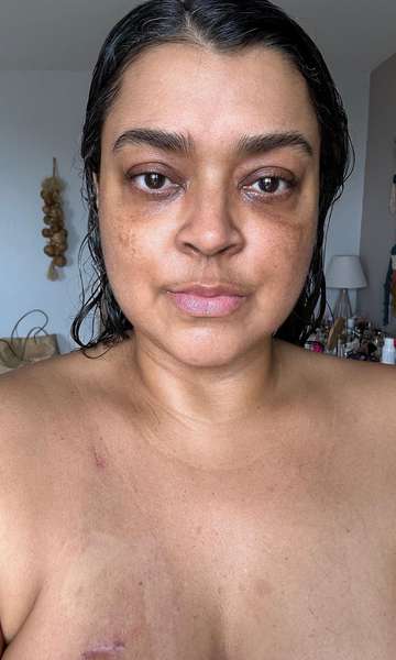 Separação da Preta Gil: veja fases e como superar um término difícil