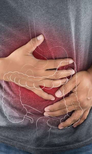 Sintomas da s&iacute;ndrome do intestino irrit&aacute;vel